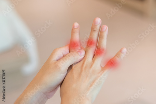 Overuse hand problems. Woman’s hand with red spot o fingers as suffer from Carpal tunnel syndrome. The symptoms of tingling, numbness, weakness, or pain of the fingers and wrist.