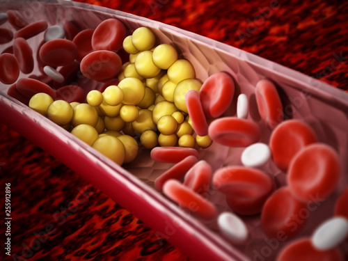 Foto Fat cells blocking the blood flow inside human vein