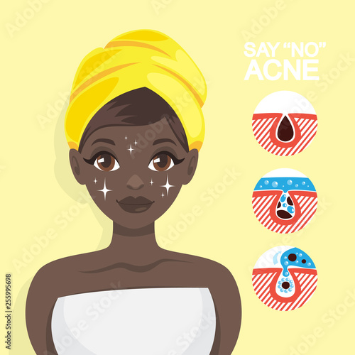 Acne treatment with face mask. Idea of beauty