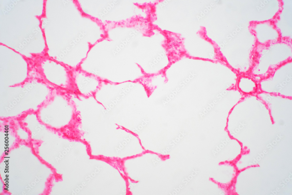 Human lung tissue under microscope view. Human lung tissue under microscope view.