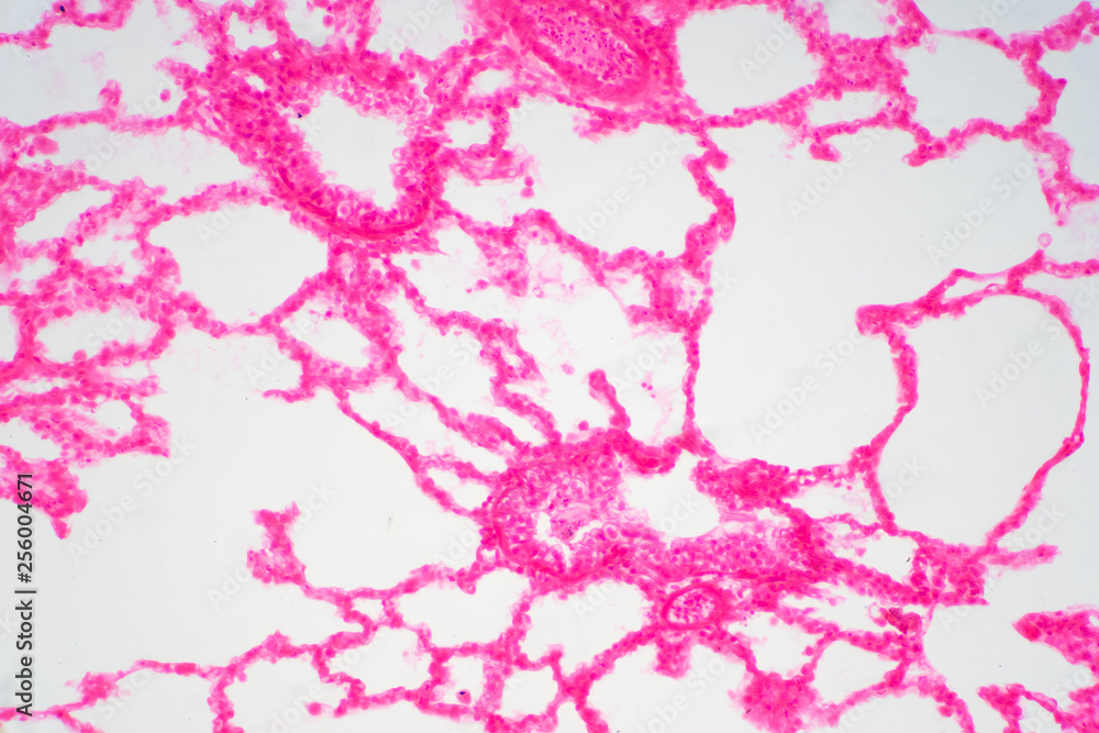 Human lung tissue under microscope view.