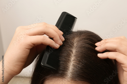 Woman with comb and dandruff in her dark hair on light background, closeup