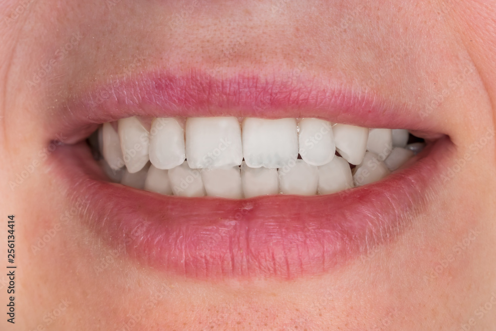 Close-up view of mouth with white teeth Close-up view of mouth with white teeth