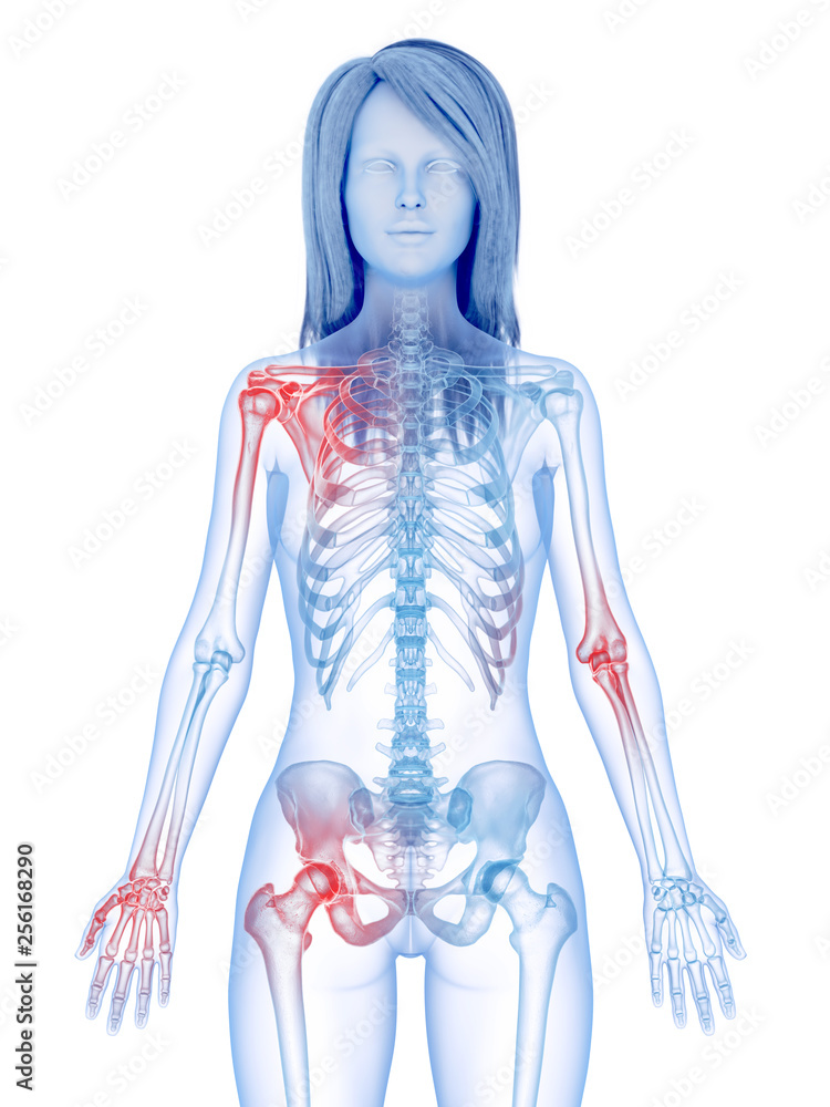 3d rendered medically accurate illustration of painful joints 3d rendered medically accurate illustration of painful joints