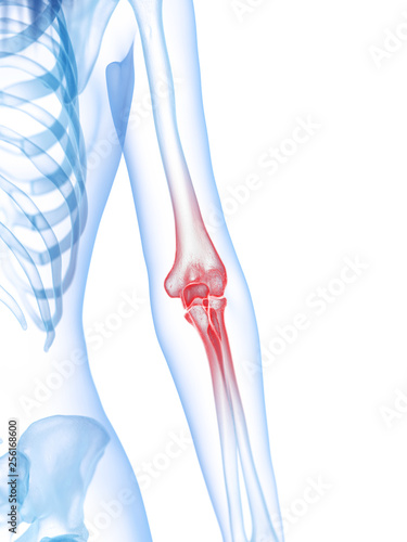 3d rendered medically accurate illustration of a painful elbow