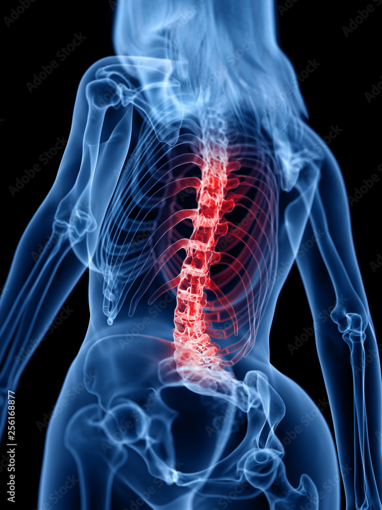 3d rendered medically accurate illustration of a painful back 3d rendered medically accurate illustration of a painful back