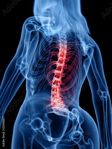 3d rendered medically accurate illustration of a painful back