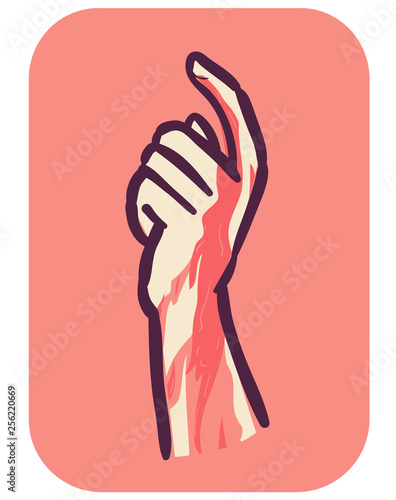 Hand Symptom Easy Bleed Illustration