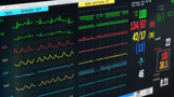 ICU monitor showing patient's condition, high temperature, arrhythmia, illness.