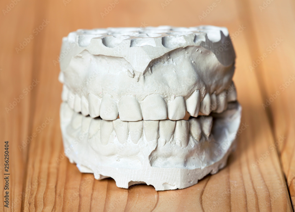 Close-up of a white teeth dental impression on wooden background, dental technics concept Close-up of a white teeth dental impression on wooden background, dental technics concept
