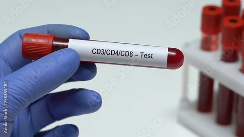 CD3 CD4 CD8-Test, doctor holding blood sample in tube close-up, health check-up photo