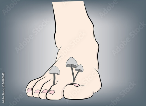 fungi on the legs. medical recommendations. vector illustration.