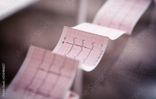 Medical cardiogram printed on paper on the table photo