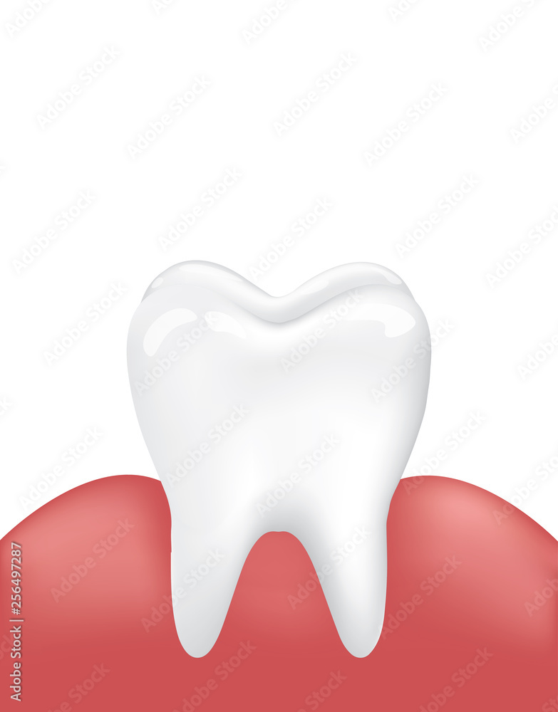 Vector Image Clean Healthy Tooth with Inflamed Gum. Medical Dental Oral Problem. Enamel Cleanliness. Isolated on White Background. Human teeth Stages of Gum Disease Vector Illustration . Vector Image Clean Healthy Tooth with Inflamed Gum. Medical Dental Oral Problem. Enamel Cleanliness. Isolated on White Background. Human teeth Stages of Gum Disease Vector Illustration .