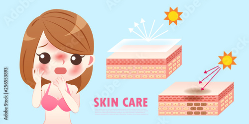 cute cartoon woman with sunburn