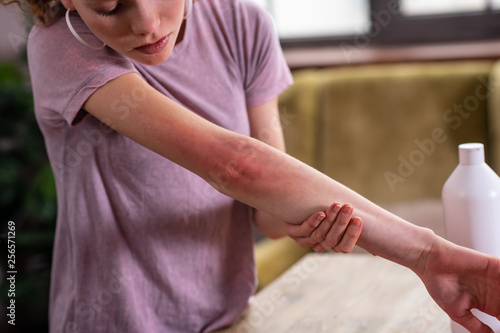 Φωτογραφία Attentive good-looking young girl being concerned about her irritated skin