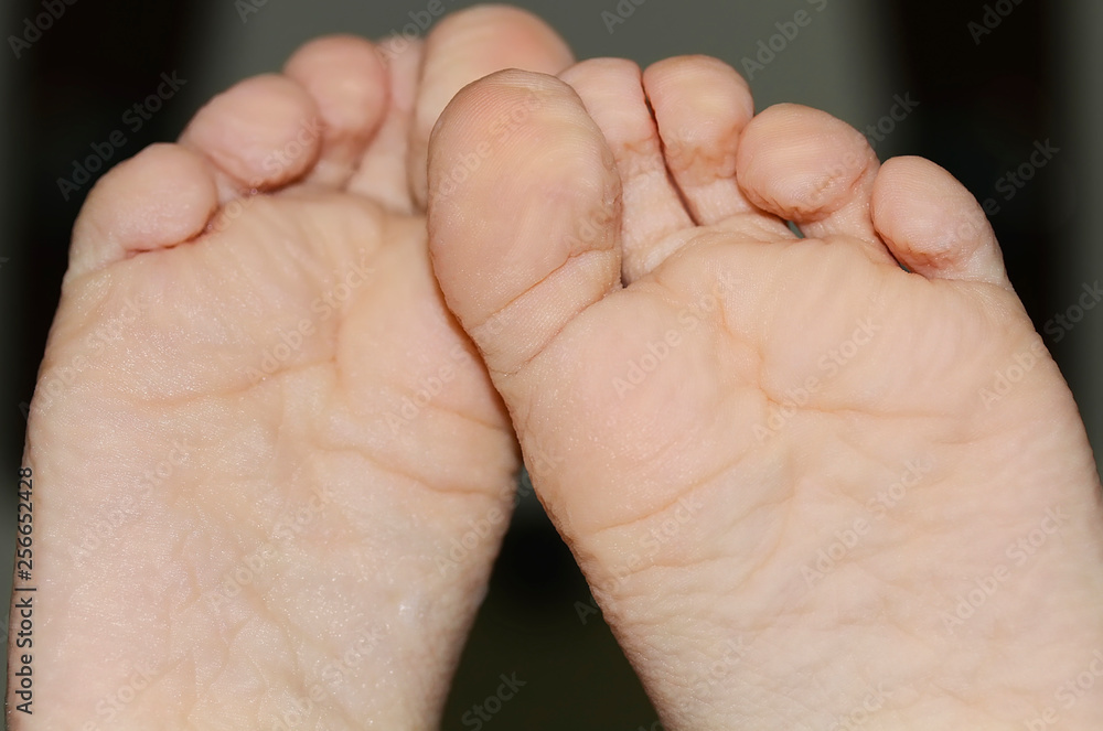 Close-up of children wrinkled feet after long bath Close-up of children wrinkled feet after long bath