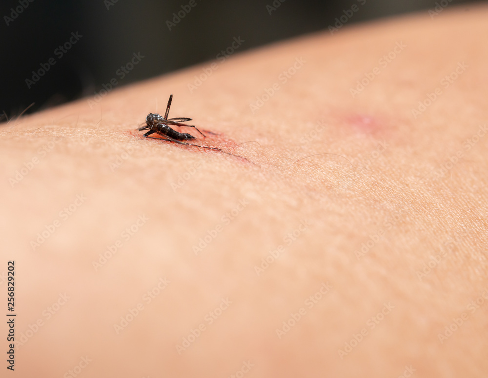 Obraz premium smashed mosquito with blood on mens arm