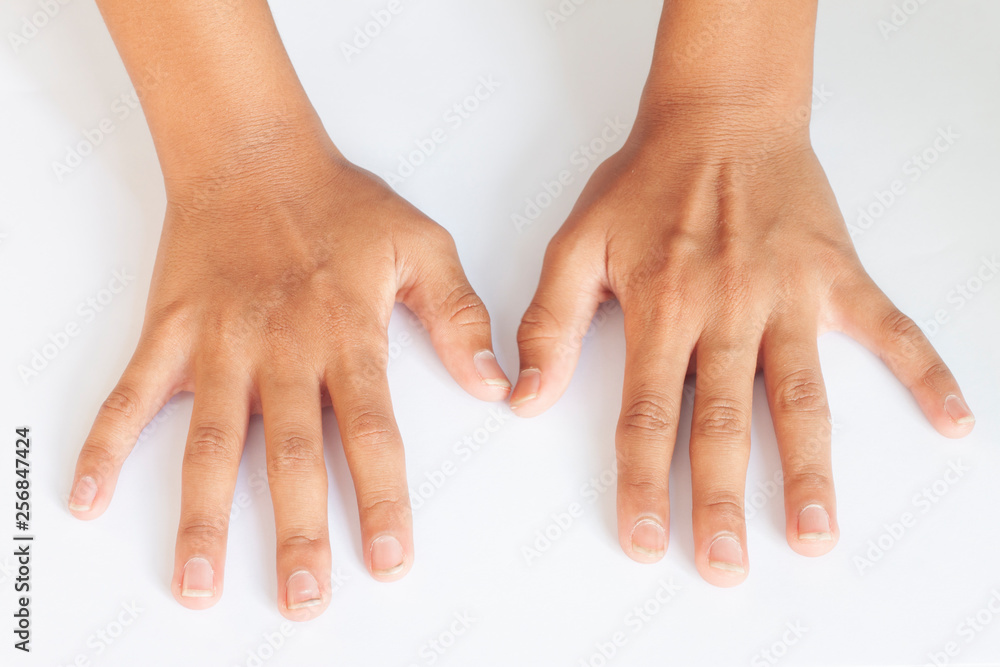 Naklejka premium Dirty long nails have germs make sick on the white paper.