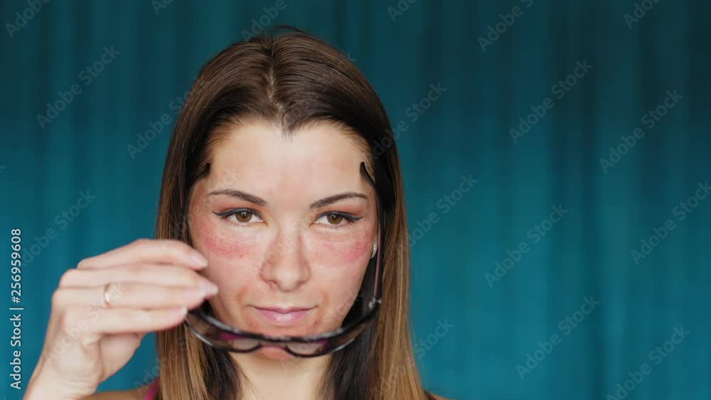The girl with hematomas on a face. A young woman looks in the mirror. Surprised face. She's wearing sunglasses. Fractional laser. Consequences of the cosmetology procedure. The girl with hematomas on a face. A young woman looks in the mirror. Surprised face. She's wearing sunglasses. Fractional laser. Consequences of the cosmetology procedure.