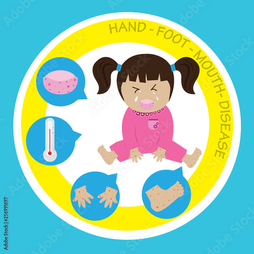 Hand Foot Mouth Disease vector illustration