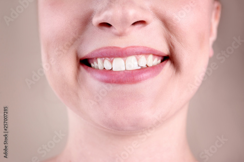 Young woman with healthy teeth smiling on color background, closeup