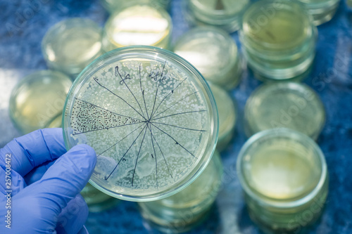 Petri dish is highlighted for analysis of bacteria. Bacteria from human intestines. A scientist in a blue glove holds a petri dish with bacteria. photo