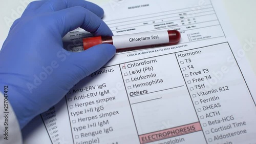 Chloroform test, doctor checking disease in lab blank, showing blood sample photo