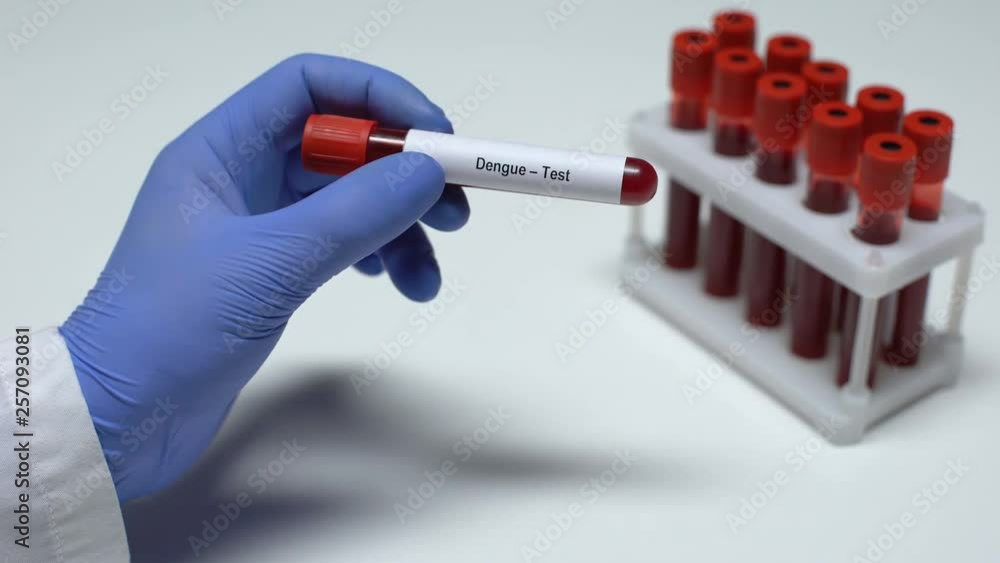 Dengue test, doctor showing blood sample in tube, lab research, health checkup Dengue test, doctor showing blood sample in tube, lab research, health checkup