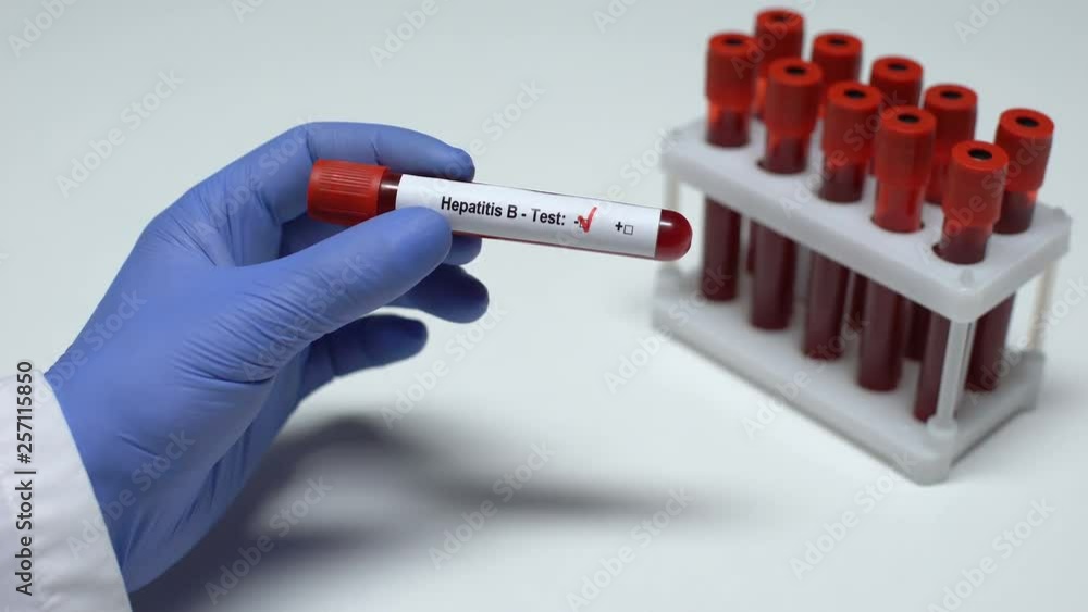 Negative Hepatitis B test, doctor showing blood sample in tube, health checkup Negative Hepatitis B test, doctor showing blood sample in tube, health checkup