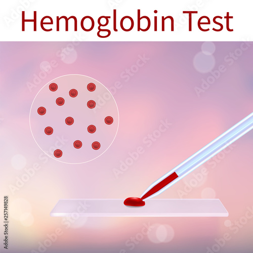 Blood test. Hemoglobin. Erythrocytes. Vector medical illustration. Pink abstract background.