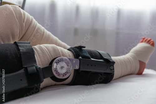 Fotografía Female leg after knee surgery in bandages and orthosis, close-up