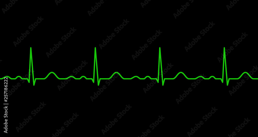 Ekg line. Heartbeat. Ekg line. Heartbeat.