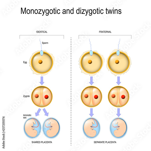 Dizygotic And Monozygotic Twins