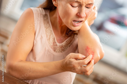 Mature woman feeling pain having reddening on neck and elbows