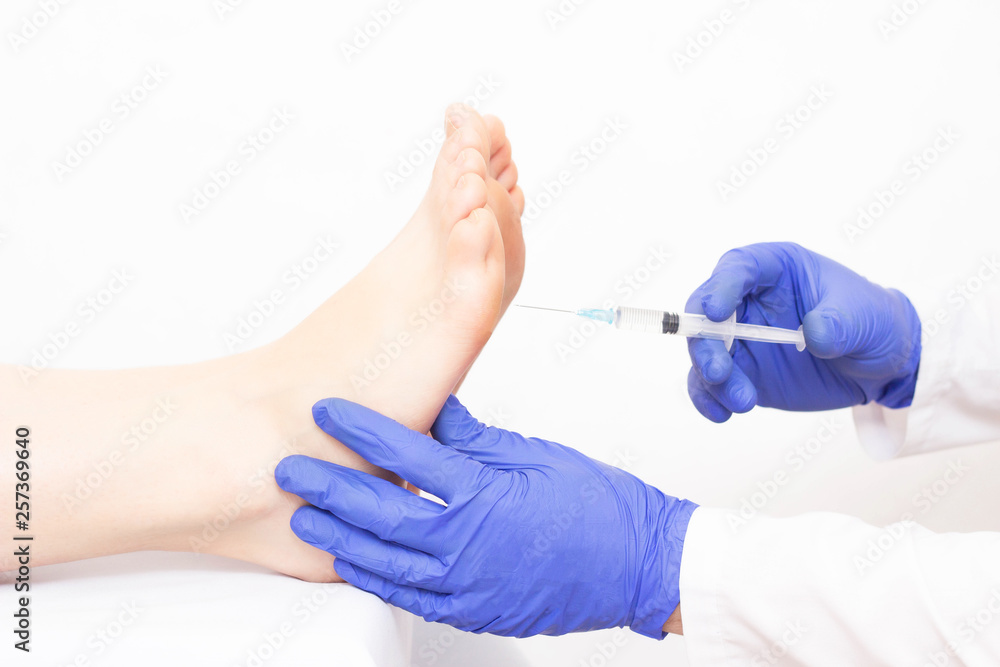 The doctor injects the patient in the foot area of the sole against hyperhidrosis, excessive sweating, the problem, close-up, treatment The doctor injects the patient in the foot area of the sole against hyperhidrosis, excessive sweating, the problem, close-up, treatment