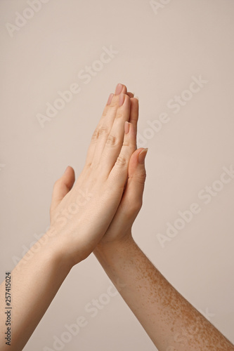 Young women touching palms on light background