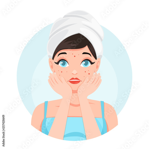 Sad woman with acne on the face