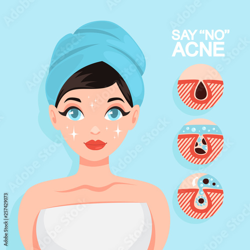 Acne treatment with face mask. Idea of beauty