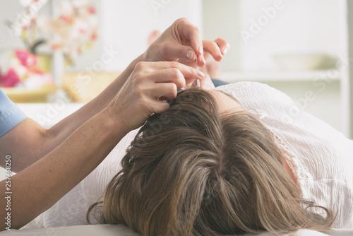 Acupuncture therapist applying acupuncture needle photo
