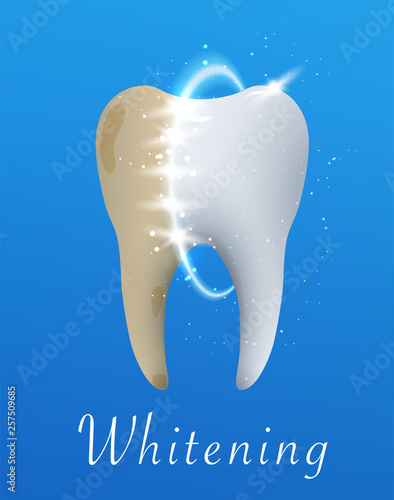 Tooth whitening Illustration. Tooth before and after whitening treatment. Graphic concept for your design