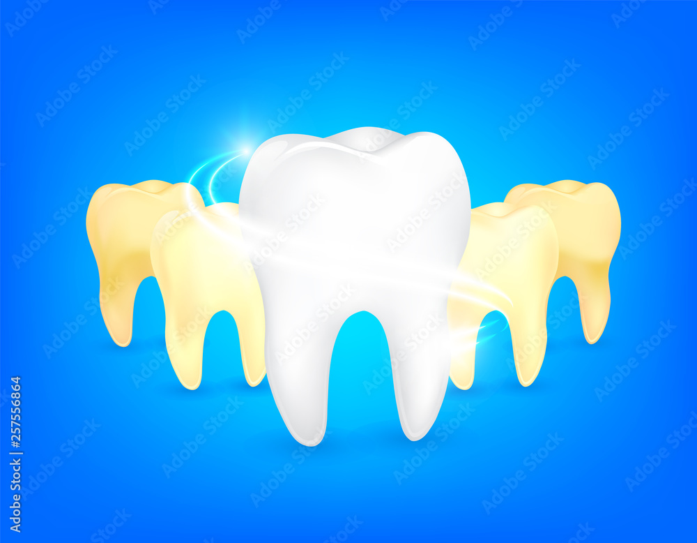 Set of clean and dirty tooth. Step of yellow to white. Dental care concept, illustration isolated on blue background. Set of clean and dirty tooth. Step of yellow to white. Dental care concept, illustration isolated on blue background.