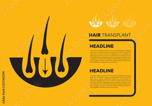 Hair transplantation vector, follicle, growth, treatment, root 