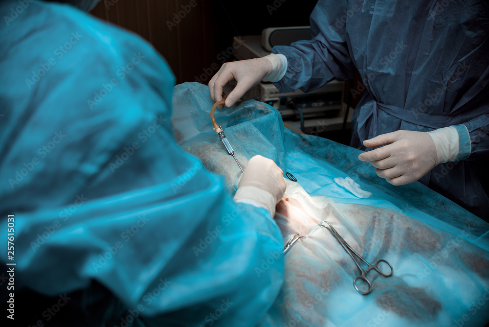 Doctors men and women in blue coats and gloves perform an operation to
