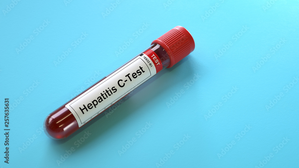 Blood sample for hepatitis-C virus test,3d rendering,conceptual image. Blood sample for hepatitis-C virus test,3d rendering,conceptual image.
