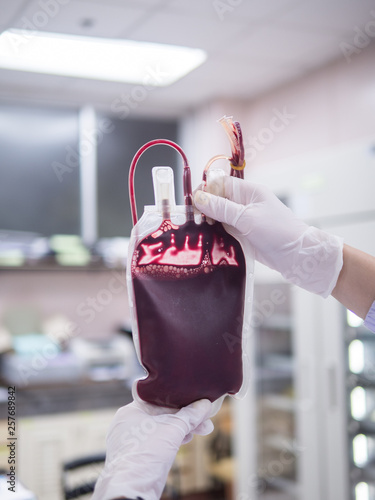 Technician checks whole blood in the bag before give to the  patient.