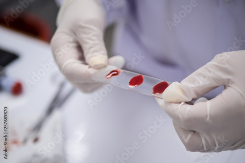 Scientist  test for blood group via agglutination method