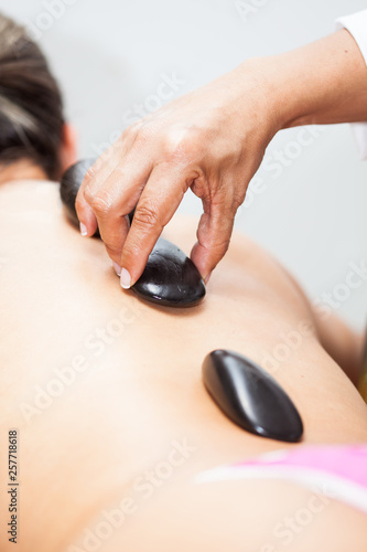 Doctor performing a hot volcanic stones therapy on a young female patient back