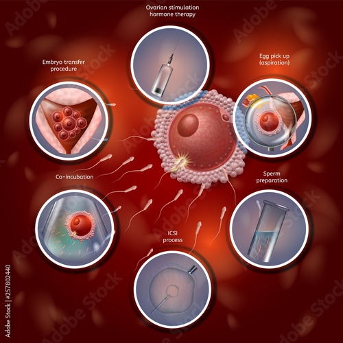 IVF Manually Combining Egg and Sperm in Lab Dish