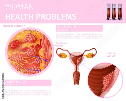 Anatomical Banner with Uterus and Breast Cancer